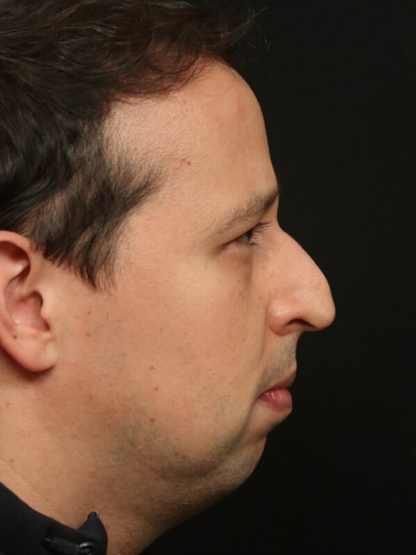 Before Image